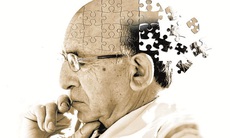 Thuốc mới có thể giúp điều trị bệnh Alzheimer