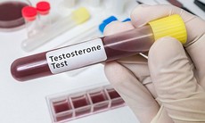 Testosterone thấp làm tăng nguy cơ mắc COVID-19 nghiêm trọng ở nam giới