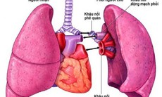 Thuốc chống đào thải dùng cho người bệnh ghép phổi