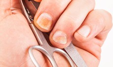 Những nguyên nhân ít ngờ cần đi khám da liễu
