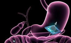 Công nghệ microchip mới cho ngành y tế trong tương lai