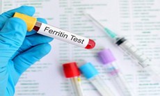 Chẩn đoán thiếu sắt và quá tải sắt qua nồng độ ferritin huyết thanh