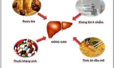 Bí quyết trị nóng gan mùa hè