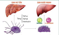 Tỷ lệ mắc viêm gan ở Việt Nam vẫn cao