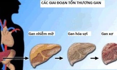 Những “sát thủ” gây tổn thương gan