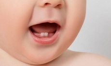 Chuyên gia hướng dẫn cách xử trí khi trẻ bị sốt khi mọc răng