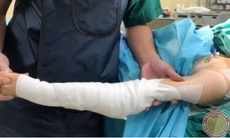 Trả lại cánh tay cho người phụ nữ 38 tuổi hơn 10 năm không thể tự chải đầu