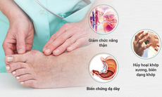 7 cách “chung sống hòa bình” với bệnh gout