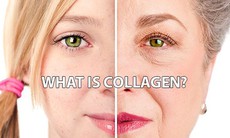 5 điều cần biết trước khi bổ sung collagen