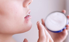 Điều trị viêm da do Herpes như thế nào?