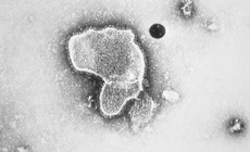 FDA ph&#234; chuẩn vaccine đầu ti&#234;n ngừa virus hợp b&#224;o h&#244; hấp (RSV)