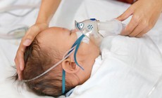 Biểu hiện nhiễm virus hợp b&#224;o h&#244; hấp RSV ở trẻ cha mẹ cần biết