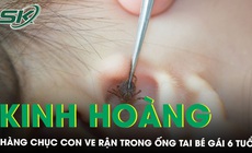 Kinh ho&#224;ng h&#224;ng chục con ve rận trong ống tai b&#233; g&#225;i 6 tuổi