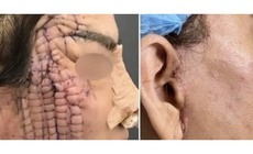 Nữ bệnh nh&#226;n tử vong sau khi phẫu thuật căng da mặt cổ