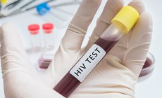Trường hợp n&#224;o n&#234;n x&#233;t nghiệm HIV?
