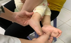 Mắc tay chân miệng độ 4 khiến trẻ nguy kịch, cha mẹ cần chú ý dấu hiệu nguy hiểm nào?