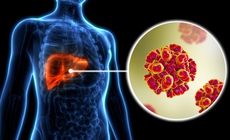 Sống khỏe với HIV v&#224; vi&#234;m gan C - tương lai đầy hy vọng cho người đồng nhiễm