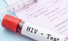 L&#224;m thế n&#224;o để biết bạn c&#243; bị nhiễm HIV hay kh&#244;ng?