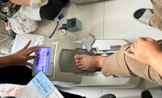 Khoảng 40% người tr&#234;n 70 tuổi c&#243; nguy cơ lo&#227;ng xương