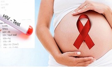 Những điều cần biết về chăm s&#243;c b&#224; mẹ c&#243; HIV ngay sau sinh