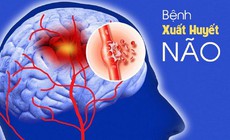 Nguy&#234;n nh&#226;n g&#226;y xuất huyết n&#227;o
