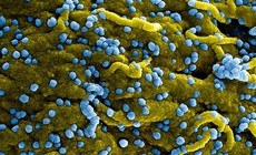 Ethiopia x&#225;c nhận 3 ca tử vong do virus Marburg