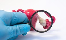 Dấu hiệu buồng trứng đa nang thường gặp