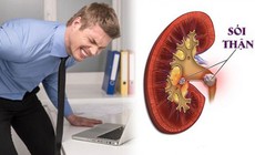 Đau lưng, tiểu s&#243;n đề ph&#242;ng sỏi thận