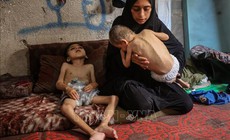 H&#224;ng ngh&#236;n trẻ em ở Gaza nhập viện v&#236; suy dinh dưỡng cấp t&#237;nh