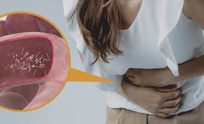 Ổ giun trong đại tràng người phụ nữ có thói quen ăn rau sống