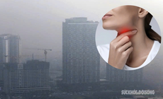 TPHCM gia tăng bệnh h&#244; hấp, tai mũi họng do &#244; nhiễm kh&#244;ng kh&#237;