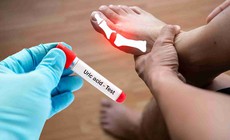 5 loại đồ uống khi đói giúp hạ axit uric cao