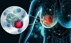 Nghiên cứu vaccine mới mở ra hy vọng chống lại ung thư vú thể nguy hiểm nhất