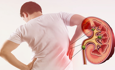7 tác nhân âm thầm gây tổn thương thận không nên bỏ qua