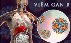 Bỏ điều trị viêm gan B mạn tính, người đàn ông nguy kịch phải ghép gan cấp cứu