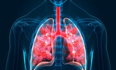 5 triệu chứng thường gặp của bệnh xơ phổi