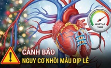 Nguy cơ nhồi máu cơ tim dịp lễ, cuối năm tăng mạnh