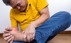 Cảnh giác với 2 loại đồ uống có thể làm bùng phát cơn gout cấp trong kỳ nghỉ lễ