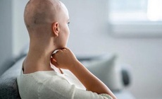 Chăm s&#243;c khi t&#243;c mọc lại ở bệnh nh&#226;n ung thư