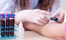 Khi n&#224;o cần l&#224;m x&#233;t nghiệm m&#225;u, yếu tố ảnh hưởng đến kết quả x&#233;t&#160;nghiệm?