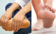 Điều trị kịp thời ca bệnh di truyền hiếm gặp sau nhiều năm bị chẩn đo&#225;n nhầm