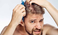 Rụng t&#243;c ở nam giới v&#224; giải ph&#225;p khắc phục