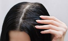 N&#234;n ăn g&#236; để l&#224;m đen t&#243;c?