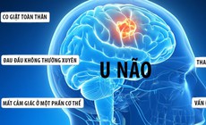Đau đầu cảnh gi&#225;c với u m&#224;ng n&#227;o
