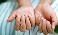 Bổ sung vitamin v&#224; kho&#225;ng chất n&#224;o khi m&#243;ng tay gi&#242;n, dễ g&#227;y?