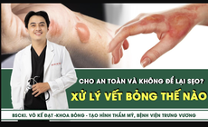 [LIVE] Xử l&#253; vết bỏng thế n&#224;o cho an to&#224;n v&#224; kh&#244;ng để lại sẹo?