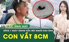 Bản Tin Y Tế 26/7: Ph&#225;t hiện con vắt 8cm c&#242;n sống trong hốc mũi người đ&#224;n &#244;ng 