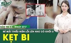 Bản Tin Y Tế 27/7: Vi&#234;n bi sắt 6mm kẹt trong m&#237; mắt thiếu ni&#234;n 15 tuổi