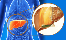 Th&#234;m liệu ph&#225;p điều trị virus vi&#234;m gan C cấp t&#237;nh