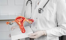 6 bệnh l&#253; c&#243; thể phải phẫu thuật cắt bỏ tử cung